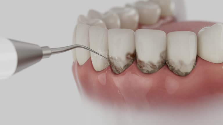 Reliable Emergency Dentist contractor in Pierson, FL by Smile Center Dentistry